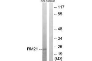 Western blot analysis of extracts from COLO cells, using MRPL21 Antibody.