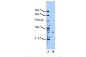 Image no. 1 for anti-Methyltransferase Like 1 (METTL1) (AA 151-200) antibody (ABIN341635) (METTL1 anticorps  (AA 151-200))