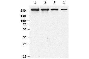 Western Blotting (WB) image for anti-Mechanistic Target of Rapamycin (serine/threonine Kinase) (mTOR) antibody (ABIN2665280) (MTOR anticorps)