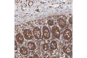 Immunohistochemical staining of human small intestine with COX8C polyclonal antibody  shows strong cytoplasmic and membranous positivity with granular pattern in glandular cells. (COX8C anticorps)