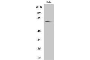Western Blotting (WB) image for anti-Amphiphysin (AMPH) (Internal Region) antibody (ABIN3173773) (Amphiphysin anticorps  (Internal Region))