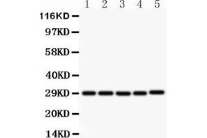 Western blot analysis of sCD40L using anti- sCD40L antibody . (CD40 Ligand anticorps  (N-Term))