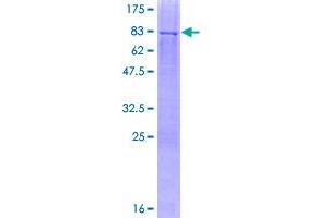 Image no. 1 for Hexosaminidase D (HEXDC) (AA 1-493) protein (GST tag) (ABIN1306563)
