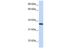 Lipocalin 12 antibody used at 1 ug/ml to detect target protein. (LCN12 anticorps  (N-Term))
