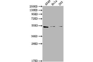 Western Blot Positive WB detected in: A549 whole cell lysate, Hela whole cell lysate, 293 whole cell lysate All lanes: CNR1 antibody at 1:2000 Secondary Goat polyclonal to rabbit IgG at 1/50000 dilution Predicted band size: 53, 46, 50 kDa Observed band size: 53 kDa (CNR1 anticorps  (AA 1-116))