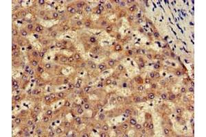 Immunohistochemistry of paraffin-embedded human liver tissue using ABIN7170102 at dilution of 1:100