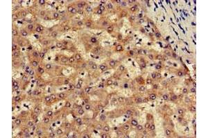 Immunohistochemistry of paraffin-embedded human liver tissue using ABIN7170102 at dilution of 1:100 (SLC13A5 anticorps  (AA 156-204))