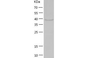 Western Blotting (WB) image for Ethanolamine Kinase 2 (ETNK2) (AA 1-386) protein (His-IF2DI Tag) (ABIN7122821)