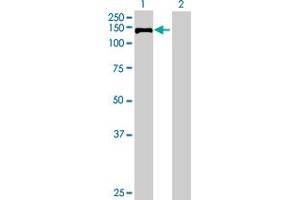 Western Blot analysis of TUBGCP5 expression in transfected 293T cell line by TUBGCP5 MaxPab polyclonal antibody.