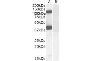 ABIN238594 (0. (EPB41L2 anticorps  (Internal Region))