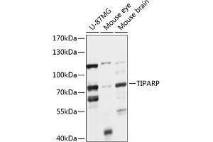Western blot analysis of extracts of various cell lines, using TIPARP antibody (ABIN7270752) at 1:1000 dilution. (Tiparp anticorps  (AA 1-320))
