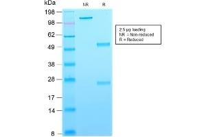 SDS-PAGE Analysis Purified CD63-Monospecific Mouse Recombinant Monoclonal Antibody (rMX-49.