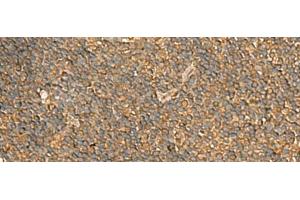 Immunohistochemistry of paraffin-embedded Human tonsil tissue using ENO3 Polyclonal Antibody at dilution of 1:70(x200)