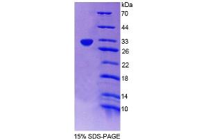 SDS-PAGE analysis of Rat CAR Protein. (NR1I3 Protéine)