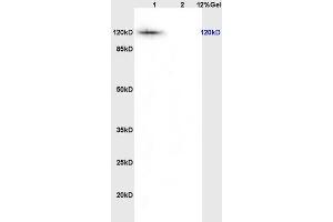 L1 rat thyriod lysates L2 rat brain lysates probed with Anti KIF11/Eg5/TRIP5 Polyclonal Antibody, Unconjugated (ABIN872373) at 1:200 overnight at 4 °C. (K11 (AA 351-450) anticorps)
