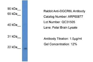 Western Blotting (WB) image for anti-DiGeorge Syndrome Critical Region Gene 6-Like (DGCR6L) (C-Term) antibody (ABIN2788616) (DGCR6L anticorps  (C-Term))