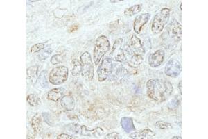 Immunohistochemistry (IHC) image for anti-Methyltransferase Like 3 (METTL3) (AA 1-50) antibody (ABIN7448668) (METTL3 anticorps  (AA 1-50))