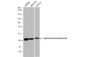 WB Image alpha smooth muscle Actin antibody detects alpha smooth muscle Actin protein by western blot analysis.
