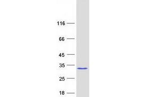 Validation with Western Blot