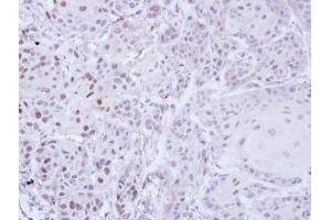 IHC-P Image Immunohistochemical analysis of paraffin-embedded Cal27 Xenograft, using ZNF165, antibody at 1:100 dilution. (ZNF165 anticorps)