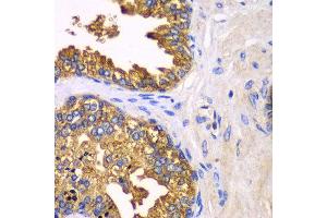 Immunohistochemistry of paraffin-embedded human prostate using SRP19 antibody at dilution of 1:100 (x40 lens). (SRP19 anticorps)