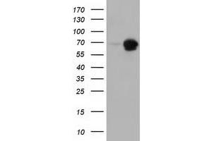 Western Blotting (WB) image for anti-Adenylate Kinase 5 (AK5) antibody (ABIN1496537) (Adenylate Kinase 5 anticorps)