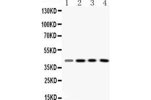 Western blot analysis of VASP expression in rat liver extract ( Lane 1), mouse kidney extract ( Lane 2), HELA whole cell lysates ( Lane 3) and HEPG2 whole cell lysates ( Lane 4). (VASP anticorps  (N-Term))