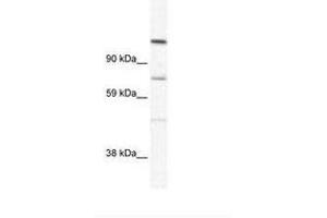 Image no. 1 for anti-Ras Association and DIL Domains (Radil) (AA 916-965) antibody (ABIN305634) (Radil anticorps  (AA 916-965))