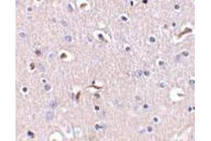 Immunohistochemistry of APH1 in human brain tissue with APH1 antibody at 5 μg/ml.
