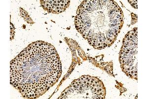 ABIN7095767 and ABIN7099829 at 1/100 staining mouse testis tissue by IHC-P. (RBM25 anticorps)