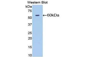 Western Blotting (WB) image for anti-5'-Nucleotidase, Ecto (CD73) (NT5E) (AA 29-550) antibody (ABIN1077721) (CD73 anticorps  (AA 29-550))