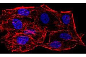 Immunofluorescence analysis of HeLa cells using SIRT6 mouse mAb. (SIRT6 anticorps  (AA 141-250))