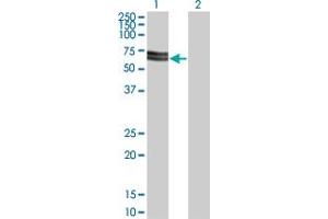 Western Blot analysis of SH3PX3 expression in transfected 293T cell line by SH3PX3 monoclonal antibody (M03), clone 3A1.