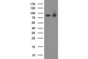 Western Blotting (WB) image for anti-Protein Kinase C, epsilon (PRKCE) antibody (ABIN1500231) (PKC epsilon anticorps)