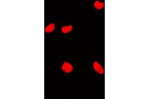 Immunofluorescent analysis of KAT7 staining in MCF7 cells. (MYST2 anticorps  (Center))