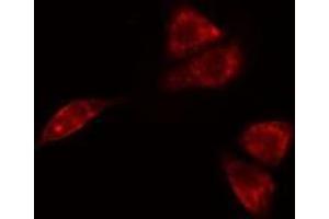 ABIN6275697 staining  A549 cells by IF/ICC. (SLC30A4 anticorps  (Internal Region))