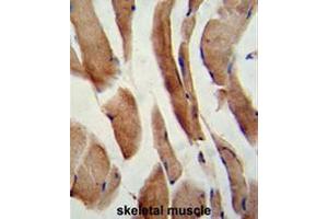 Formalin-fixed and paraffin-embedded human skeletal muscle reacted with CFLAR Antibody (Center), which was peroxidase-conjugated to the secondary antibody, followed by DAB staining.