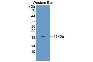 Detection of Recombinant ZBP1, Human using Polyclonal Antibody to Z-DNA Binding Protein 1 (ZBP1) (ZBP1 anticorps  (AA 10-167))