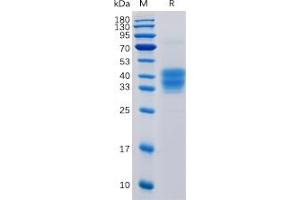 Human CD52 Protein, mFc Tag on SDS-PAGE under reducing condition. (CD52 Protein (CD52) (mFc Tag))