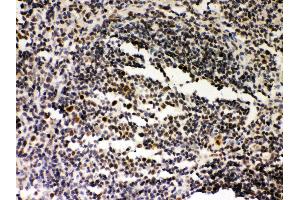Anti- SIRT7 Picoband antibody, IHC(P) IHC(P): Rat Spleen Tissue