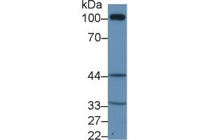 Western Blot; Sample: Rat Kidney lysate; Primary Ab: 1µg/ml Rabbit Anti-Human TP Antibody Second Ab: 0. (TBXA2R anticorps  (AA 3-324))