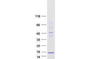 Validation with Western Blot