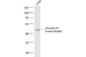 Mouse lung lysates probed with ZIP Kinase (Thr265) Polyclonal Antibody, Unconjugated  at 1:300 dilution and 4˚C overnight incubation. (DAPK3 anticorps  (pThr265))