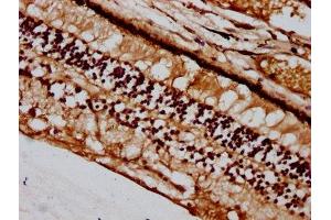 IHC image of ABIN7163038 diluted at 1:400 and staining in paraffin-embedded human eye tissue performed on a Leica BondTM system.