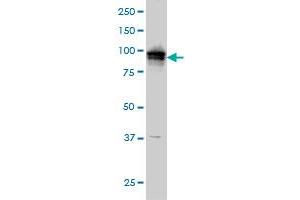 ADAM9 monoclonal antibody (M01), clone 3E6 Western Blot analysis of ADAM9 expression in A-431 .