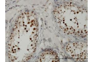 Immunoperoxidase of monoclonal antibody to TCF19 on formalin-fixed paraffin-embedded human testis.