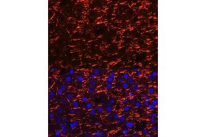 Immunofluorescence analysis of mouse brain cells using PLP1 Rabbit pAb (ABIN7269724) at dilution of 1:100 (40x lens).