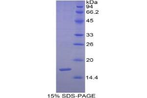SDS-PAGE analysis of Human Semaphorin 3F Protein. (SEMA3F Protéine)
