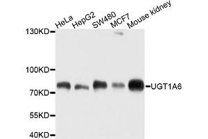 Western blot analysis of extracts of various cell lines, using UGT1A6 antibody (ABIN4905553) at 1:1000 dilution. (UGT1A6 anticorps)