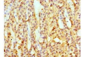 Immunohistochemistry of paraffin-embedded human adrenal gland tissue using ABIN7145594 at dilution of 1:100 (SULT2A1 anticorps  (AA 1-145))